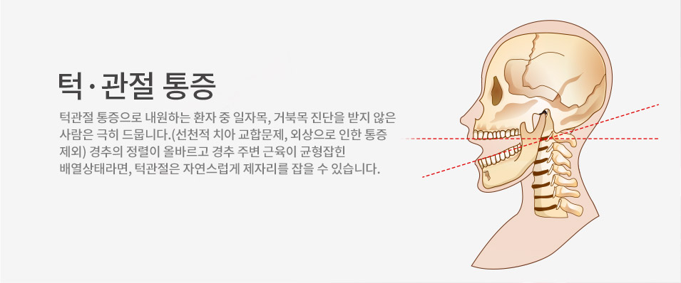 턱 · 관절 통증